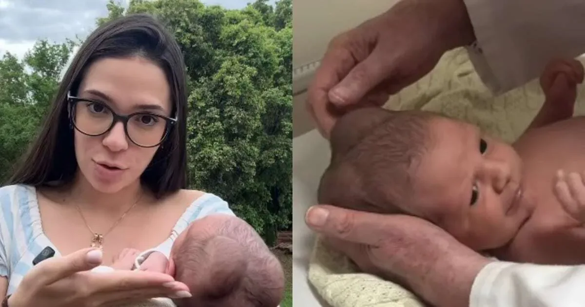 Daiane explica calombos na cabeça do filho recém-nascido
